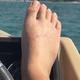 madtoe